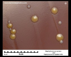 staphylococci on chocolate agar, s.aureus and s.epidermidis colonies